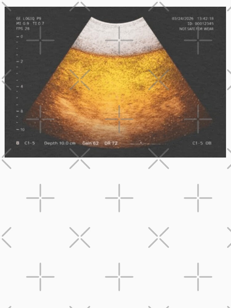 Beer Ultrasound by Soceitiz
