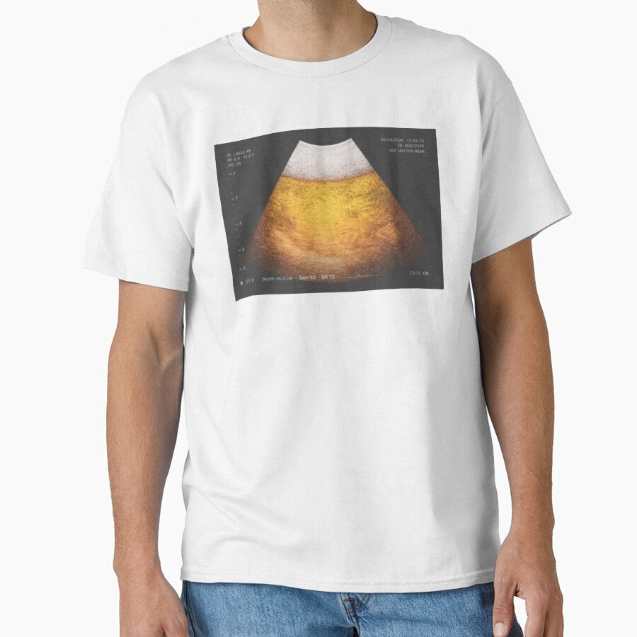 Beer Ultrasound by Soceitiz