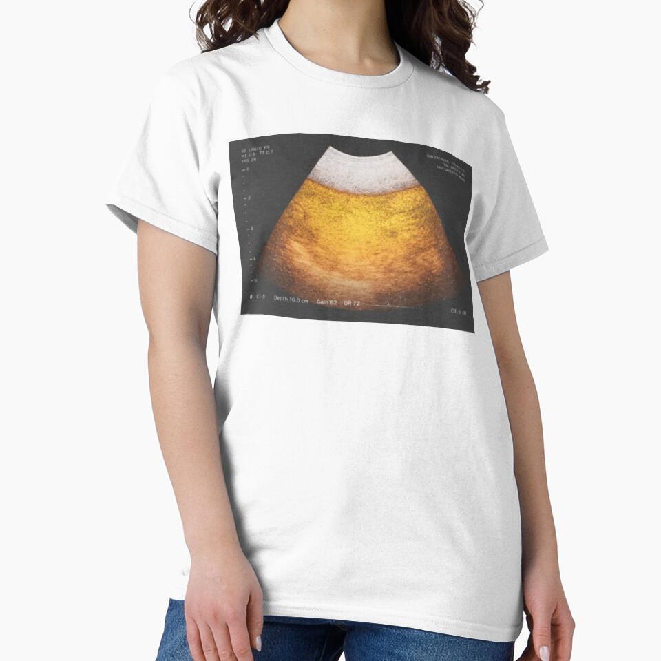 Beer Ultrasound by Soceitiz